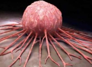 الشعور بالألم في هذه المنطقة من الجسم ينذر بسرطان قاتل