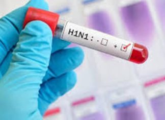 4 وفيات بسبب فيروس H1N1 في تونس