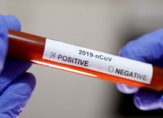 أوّل تجربة لقاح ضدّ الكورونا تُجرى الآن ..التفاصيل