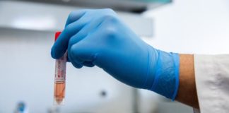 دولة عربية تعلن فقدان السيطرة على وباء كورونا وتخوف من تكرر السيناريو الايطالي