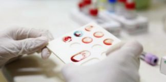 فحص طبي سريع يكشف الإصابة بكورونا.. خلال دقائق فقط