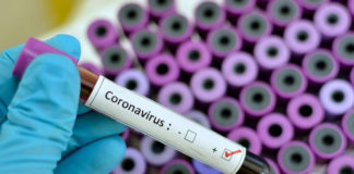 وثيقة: بعد برنامج علاء الشابي.. الصيدلية المركزية تنشر طلب عروض لاقتناء جهاز Testeurs كورونا