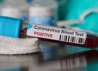 ارتفاع جديد للإصابات بكورونا في تونس