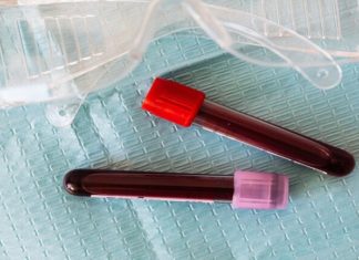 دراسة بريطانية: الرجال ينتجون أجساما مضادة لـ”كوفيد-19″ أكثر من النساء