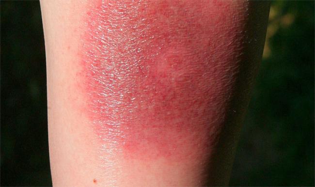 img-130