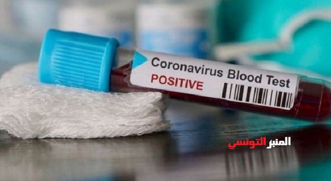 - coronavirus-test-positif_-ar-1