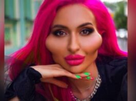 عارضة أزياء أوكرانية تحظى بـ”أكبر وجنتين في العالم”