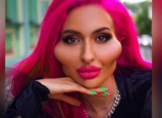 عارضة أزياء أوكرانية تحظى بـ”أكبر وجنتين في العالم”