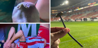 مسمار يتسبب بإصابة مروعة للاعب أثناء مباراة (صور+فيديو)