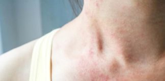 علامات جديدة تدل على الإصابة بفيروس كورونا ..