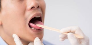 اللسان يمكن أن يكشف عن نقص معدن هام في الجسم
