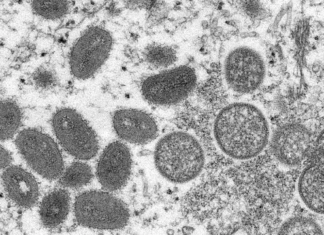 الإمارات: تسجيل 3 إصابات جديدة بجدري القردة