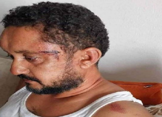 ‘الاعتداء على الصحفي سفيان بن نجيمة’.. إيقاف ثلاثة أعوان أمن